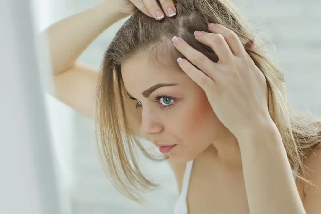 علت ریزش مو در خانم ها - دلایلی ریزش مو خانم ها - جلوگیری از ریزش مو